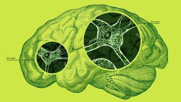 The cells that protect your brain against infection could also be behind some chronic diseases